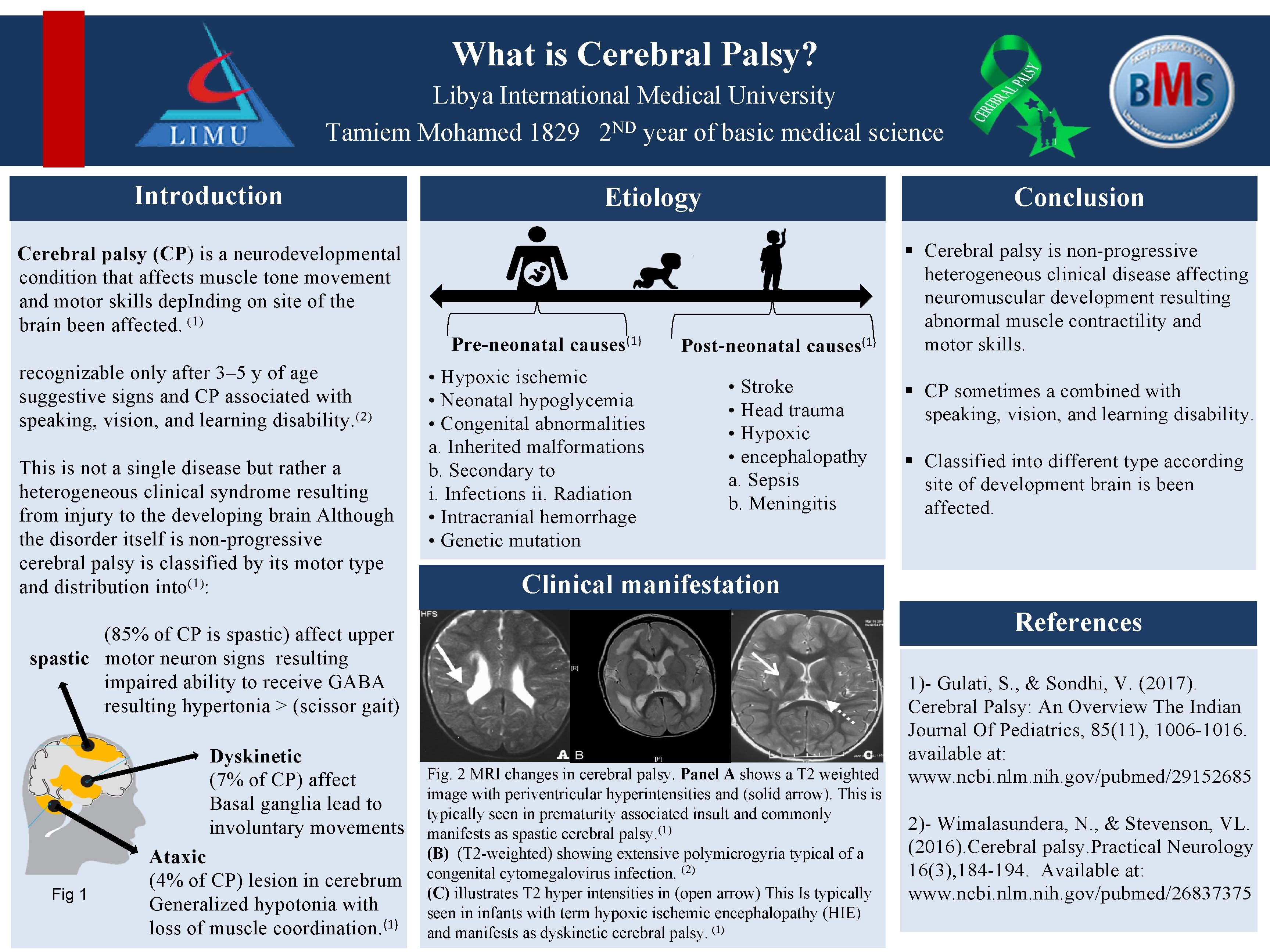 What is Cerebral Palsy? Libya International Medical University ND Tamiem Mohamed 1829 2 year