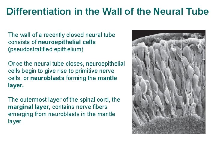 Differentiation in the Wall of the Neural Tube The wall of a recently closed