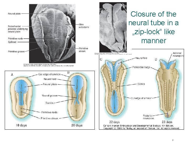 Closure of the neural tube in a „zip-lock” like manner © 2005 Elsevier )