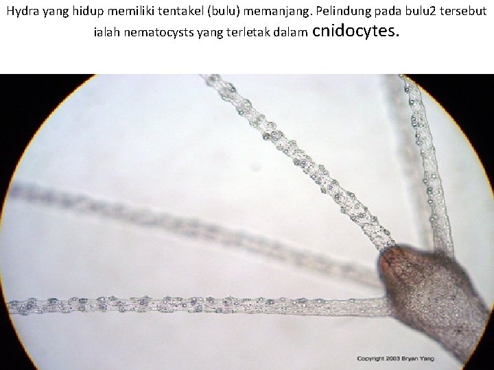 Hydra yang hidup memiliki tentakel (bulu) memanjang. Pelindung pada bulu 2 tersebut ialah nematocysts