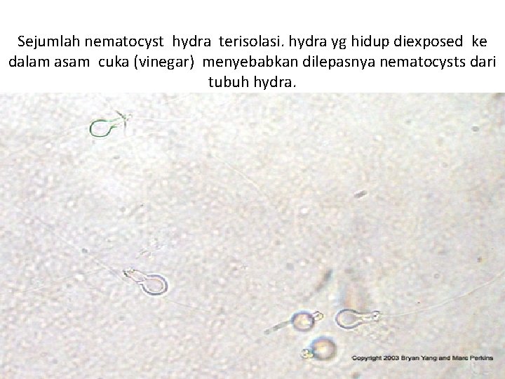 Sejumlah nematocyst hydra terisolasi. hydra yg hidup diexposed ke dalam asam cuka (vinegar) menyebabkan