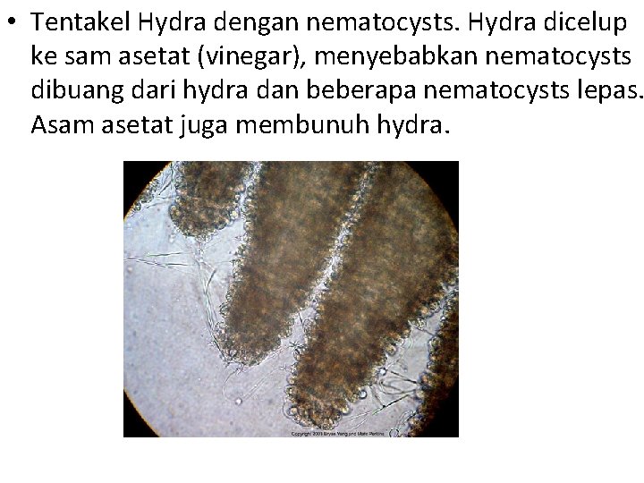  • Tentakel Hydra dengan nematocysts. Hydra dicelup ke sam asetat (vinegar), menyebabkan nematocysts