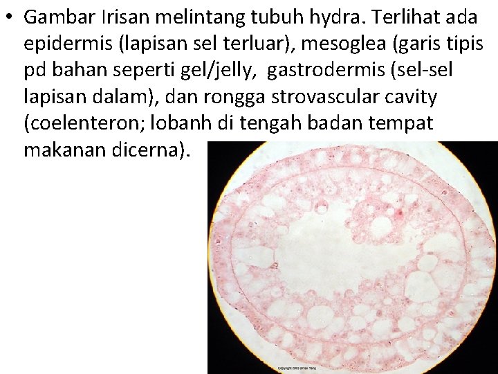  • Gambar Irisan melintang tubuh hydra. Terlihat ada epidermis (lapisan sel terluar), mesoglea