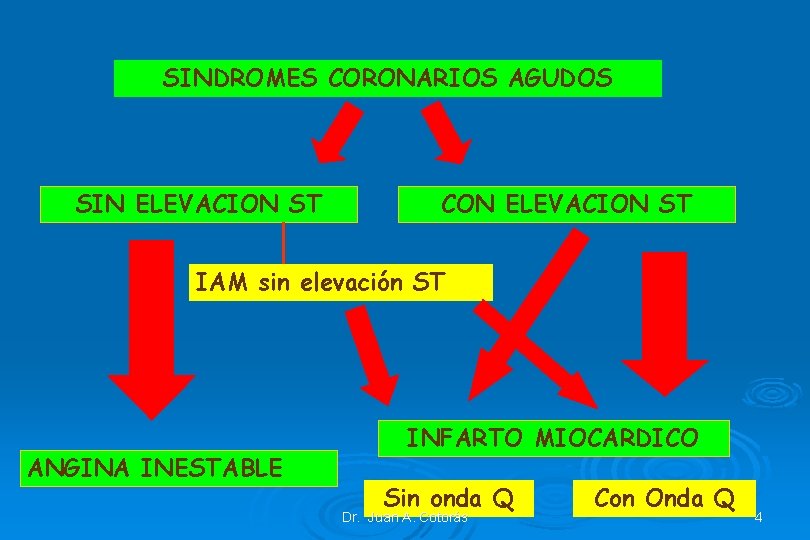 SINDROMES CORONARIOS AGUDOS SIN ELEVACION ST CON ELEVACION ST IAM sin elevación ST ANGINA