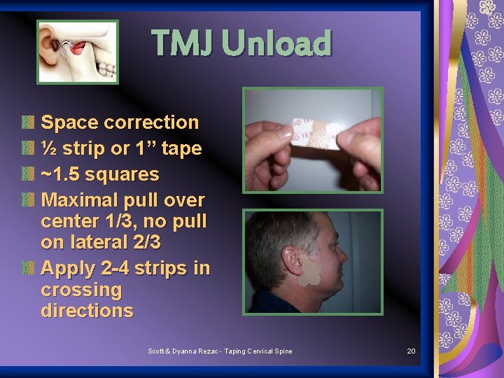 TMJ Unload Space correction ½ strip or 1” tape ~1. 5 squares Maximal pull