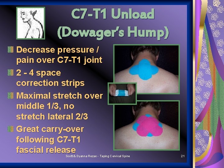 C 7 -T 1 Unload (Dowager’s Hump) Decrease pressure / pain over C 7