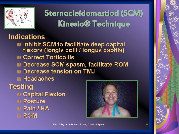 Sternocleidomastiod (SCM) Kinesio® Technique Indications Inhibit SCM to facilitate deep capital flexors (longis colli