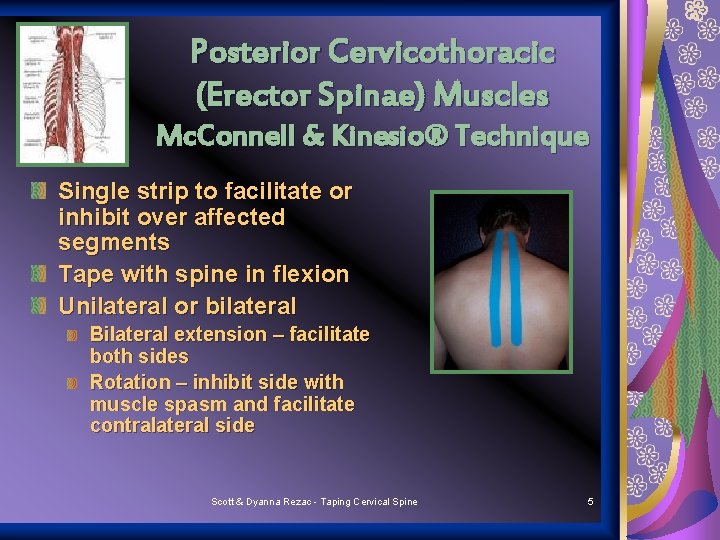 Posterior Cervicothoracic (Erector Spinae) Muscles Mc. Connell & Kinesio® Technique Single strip to facilitate