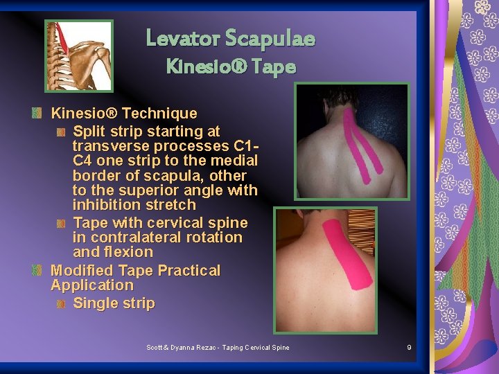 Levator Scapulae Kinesio® Tape Kinesio® Technique Split strip starting at transverse processes C 1