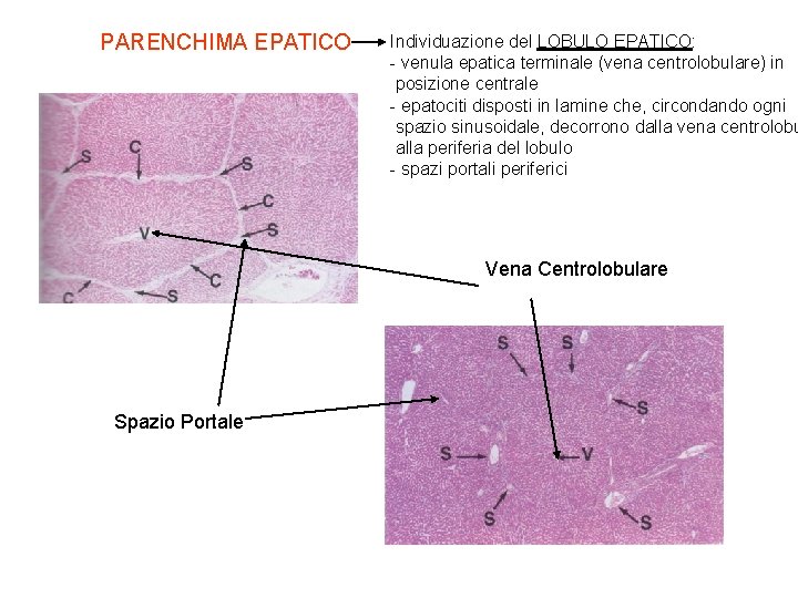 PARENCHIMA EPATICO Individuazione del LOBULO EPATICO: - venula epatica terminale (vena centrolobulare) in posizione