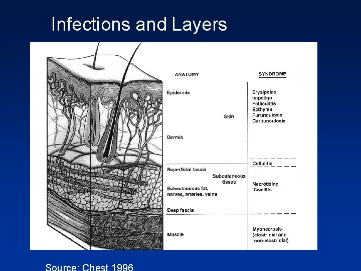 Infections and Layers 