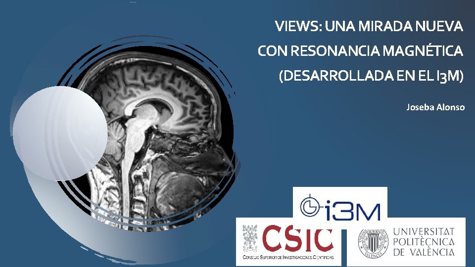 VIEWS: UNA MIRADA NUEVA CON RESONANCIA MAGNÉTICA (DESARROLLADA EN EL I 3 M) Joseba