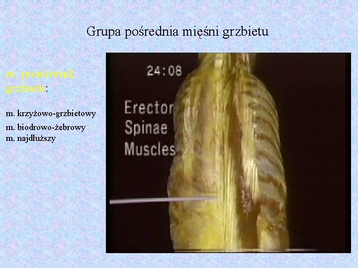 Grupa pośrednia mięśni grzbietu m. prostownik grzbietu: m. krzyżowo-grzbietowy m. biodrowo-żebrowy m. najdłuższy 