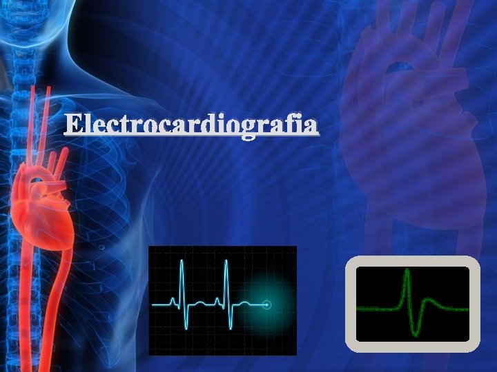 Electrocardiografia 