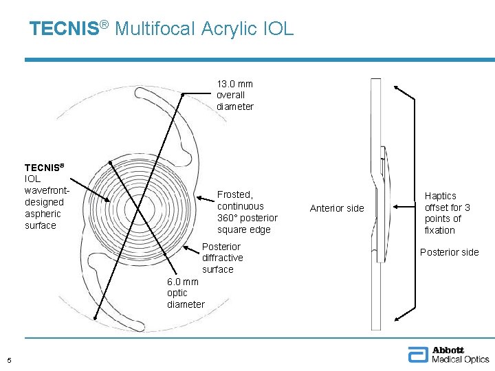 TECNIS® Multifocal Acrylic IOL 13. 0 mm overall diameter TECNIS® IOL wavefrontdesigned aspheric surface
