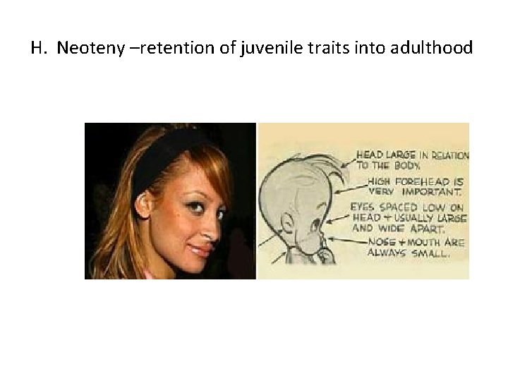 H. Neoteny –retention of juvenile traits into adulthood 