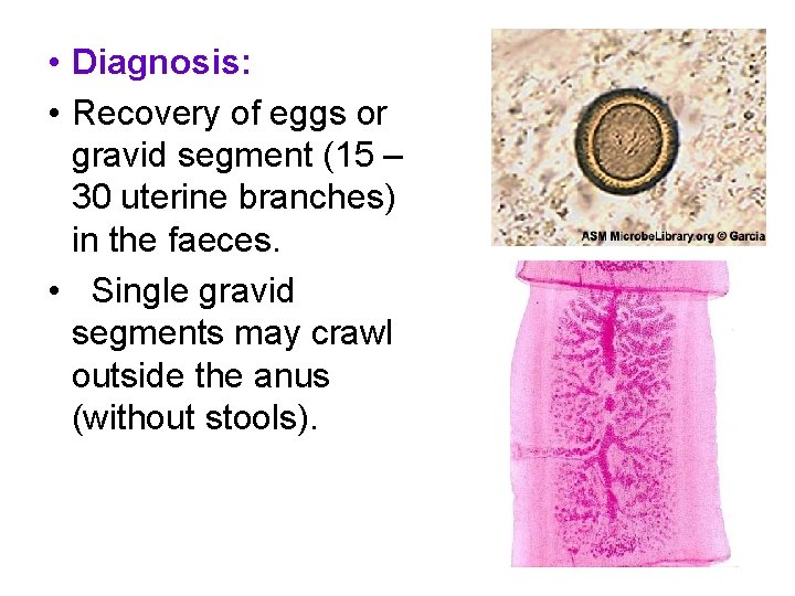  • Diagnosis: • Recovery of eggs or gravid segment (15 – 30 uterine