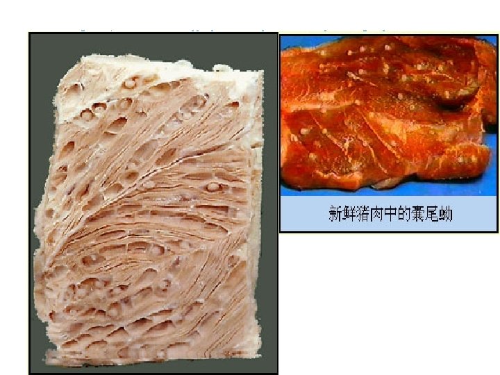 Cystcercus cellulosae in muscles of pigs (measly pork) 