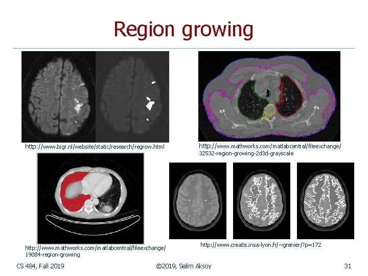 Region growing http: //www. bigr. nl/website/static/research/regrow. html http: //www. mathworks. com/matlabcentral/fileexchange/ 19084 -region-growing CS