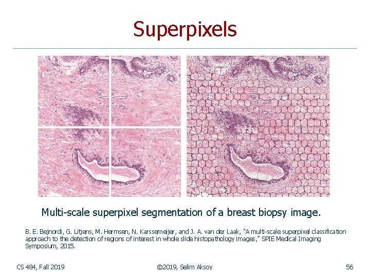 Superpixels Multi-scale superpixel segmentation of a breast biopsy image. B. E. Bejnordi, G. Litjens,