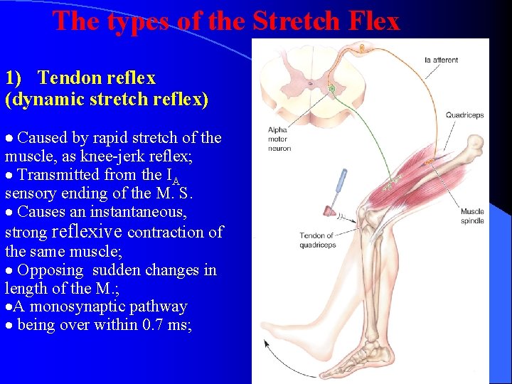 The types of the Stretch Flex 1) Tendon reflex (dynamic stretch reflex) Caused by