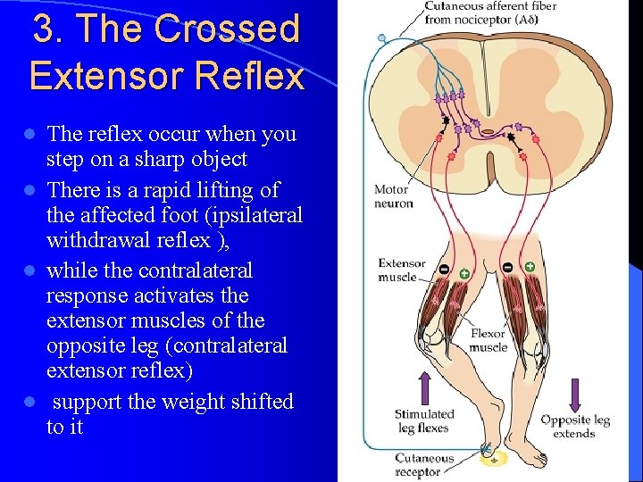 3. The Crossed Extensor Reflex The reflex occur when you step on a sharp