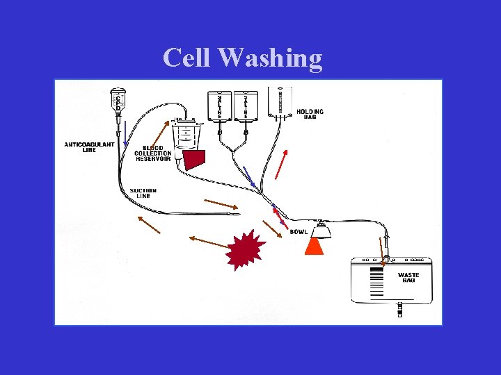 Cell Washing 