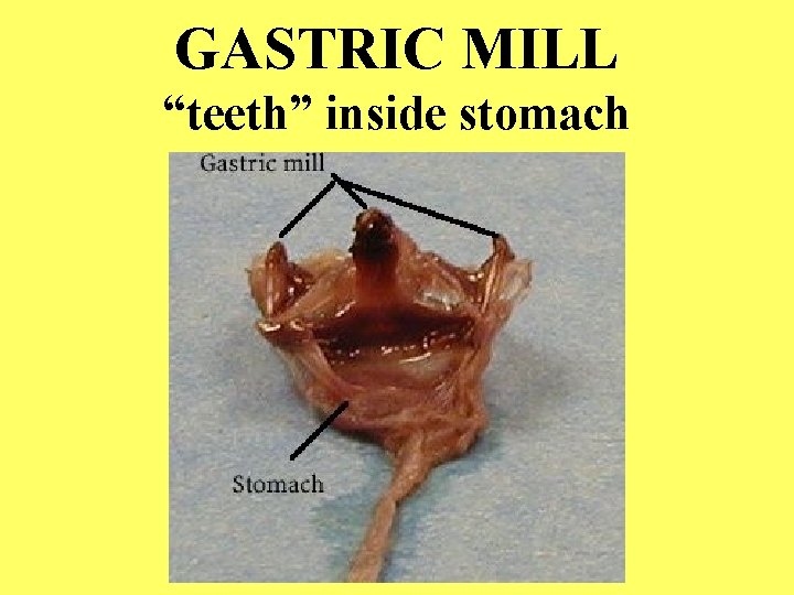 GASTRIC MILL “teeth” inside stomach 