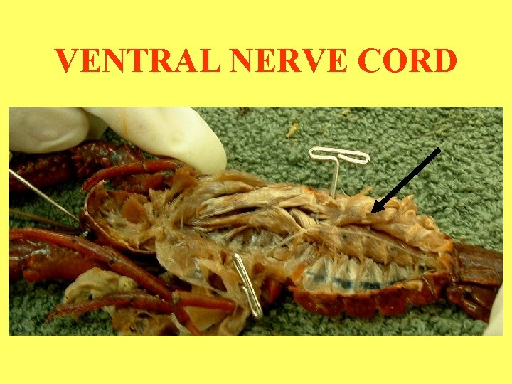 VENTRAL NERVE CORD 