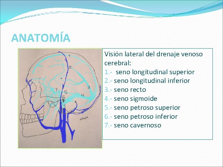 ANATOMÍA Visión lateral del drenaje venoso cerebral: 1. - seno longitudinal superior 2. - ANATOMÍA Visión lateral del drenaje venoso cerebral: 1. - seno longitudinal superior 2. -
