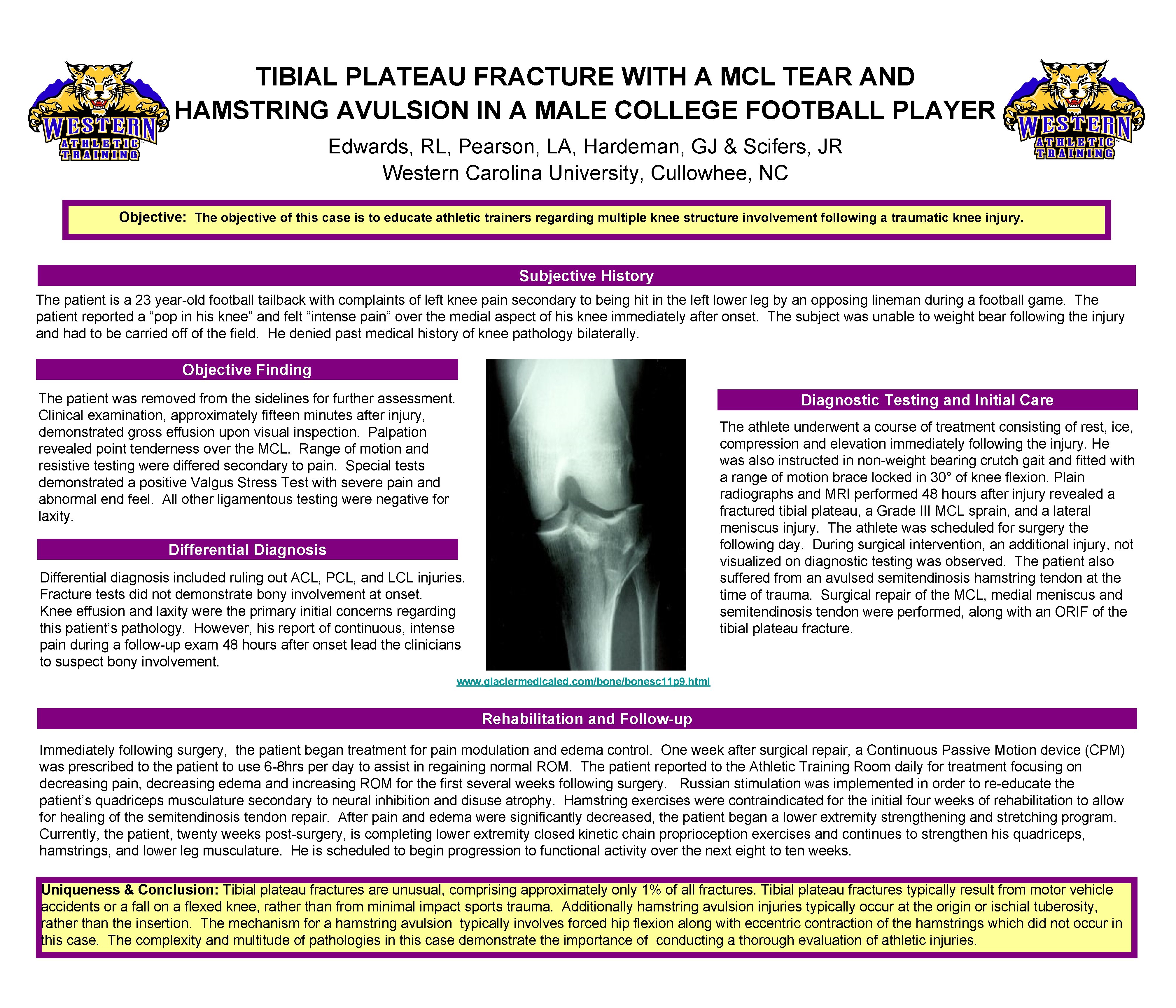 TIBIAL PLATEAU FRACTURE WITH A MCL TEAR AND HAMSTRING AVULSION IN A MALE COLLEGE