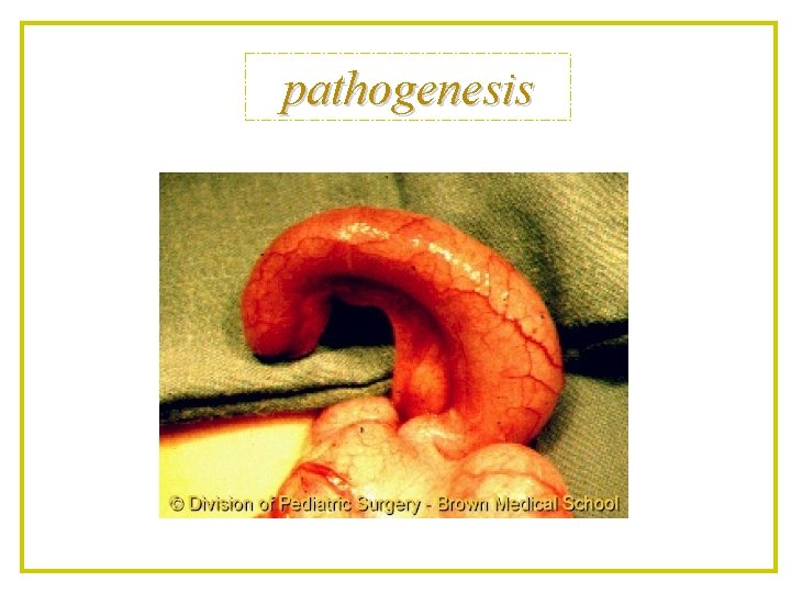 pathogenesis 