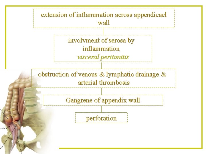 extension of inflammation across appendicael wall involvment of serosa by inflammation visceral peritonitis obstruction