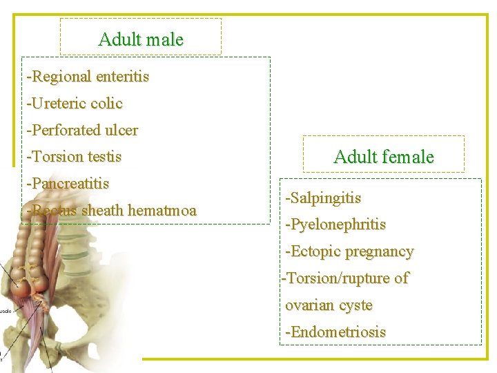 Adult male -Regional enteritis -Ureteric colic -Perforated ulcer -Torsion testis -Pancreatitis -Rectus sheath hematmoa