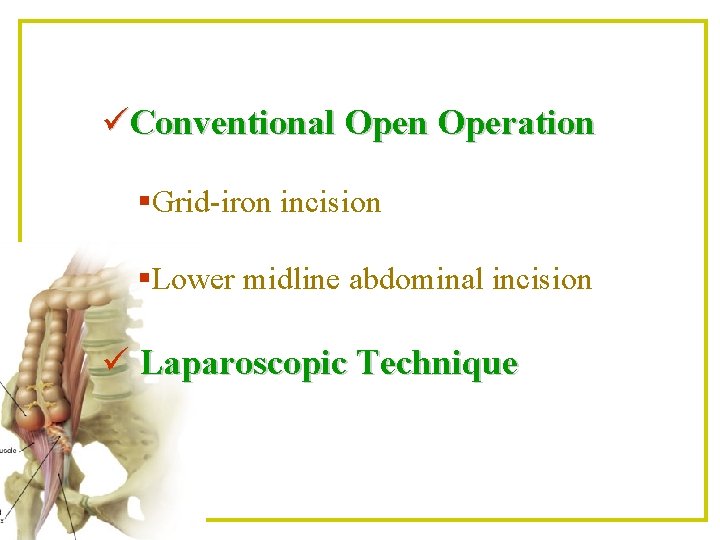 üConventional Open Operation §Grid-iron incision §Lower midline abdominal incision ü Laparoscopic Technique 