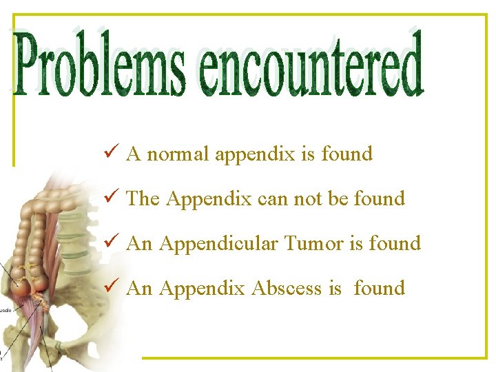 ü A normal appendix is found ü The Appendix can not be found ü