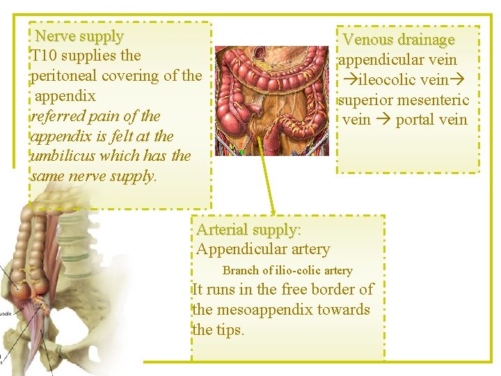 Nerve supply T 10 supplies the peritoneal covering of the appendix referred pain of