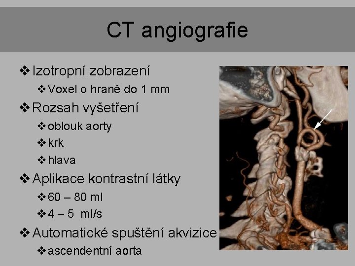 CT angiografie v Izotropní zobrazení v. Voxel o hraně do 1 mm v Rozsah CT angiografie v Izotropní zobrazení v. Voxel o hraně do 1 mm v Rozsah