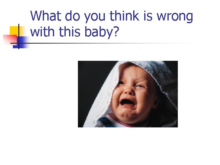 What do you think is wrong with this baby? 