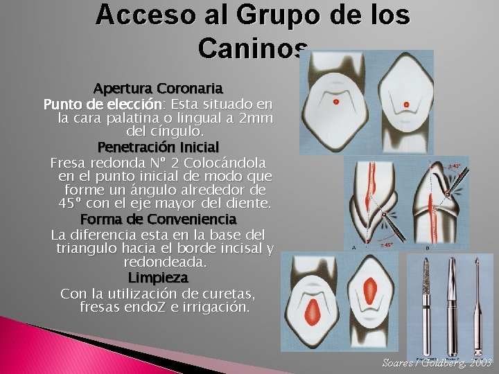 Acceso al Grupo de los Caninos Apertura Coronaria Punto de elección: Esta situado en