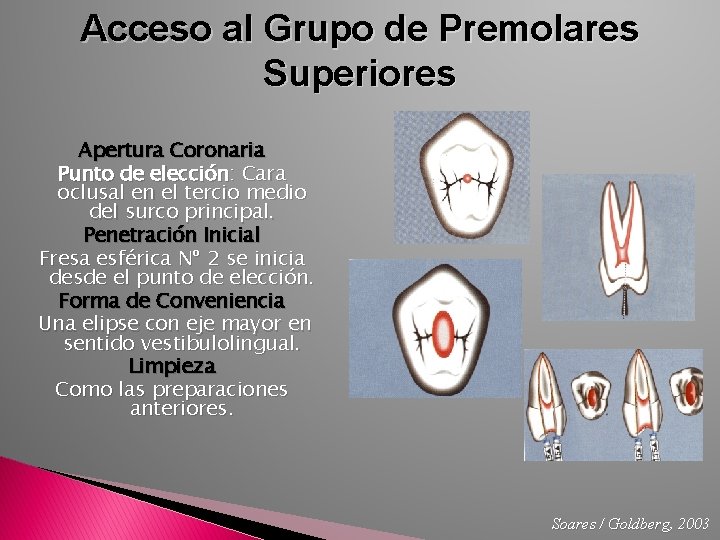Acceso al Grupo de Premolares Superiores Apertura Coronaria Punto de elección: Cara oclusal en