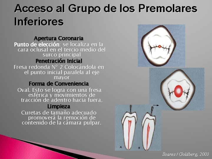 Acceso al Grupo de los Premolares Inferiores Apertura Coronaria Punto de elección: se localiza