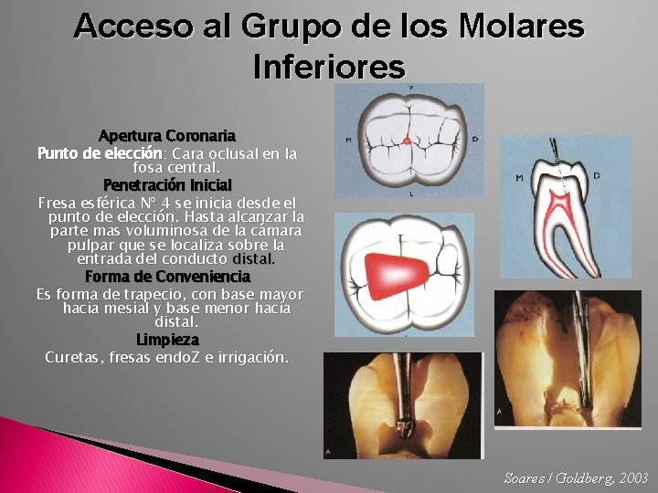 Acceso al Grupo de los Molares Inferiores Apertura Coronaria Punto de elección: Cara oclusal