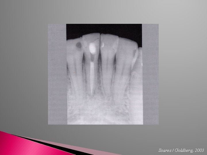Soares / Goldberg, 2003 
