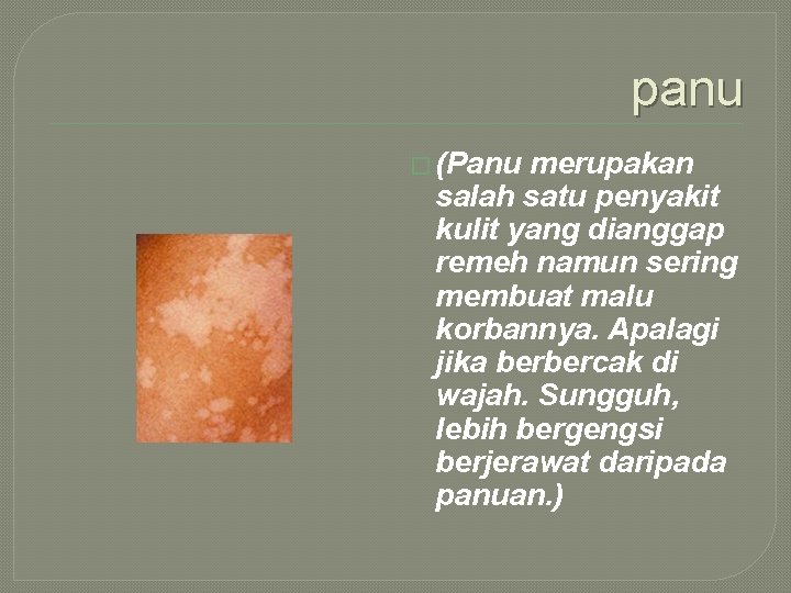 panu � (Panu merupakan salah satu penyakit kulit yang dianggap remeh namun sering membuat