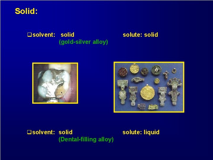 Solid: qsolvent: solid (gold-silver alloy) solute: solid qsolvent: solid (Dental-filling alloy) solute: liquid 