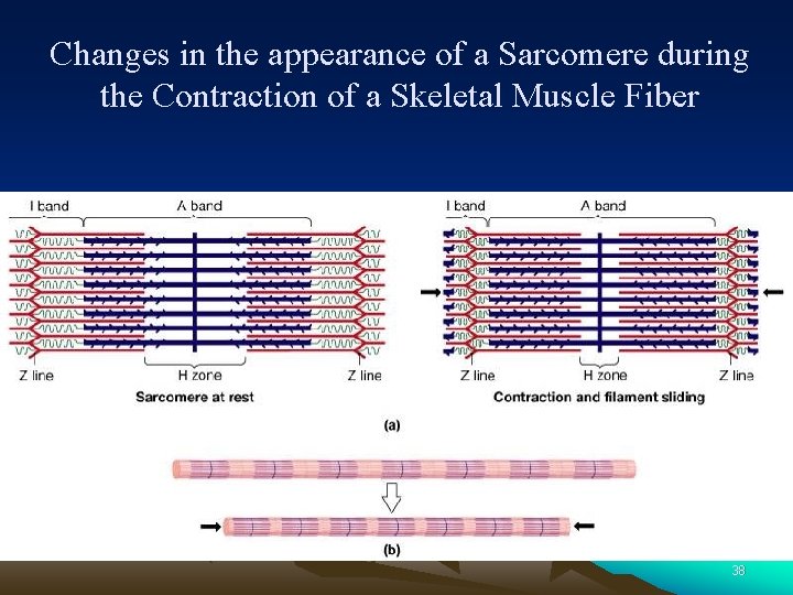 Changes in the appearance of a Sarcomere during the Contraction of a Skeletal Muscle