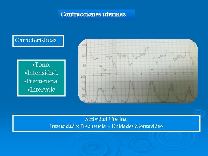 Contracciones uterinas Características • Tono. • Intensidad. • Frecuencia. • Intervalo Actividad Uterina. Intensidad