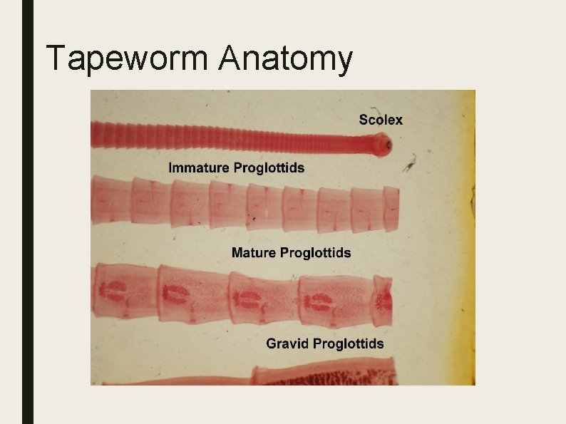 Tapeworm Anatomy Tapeworm Anatomy