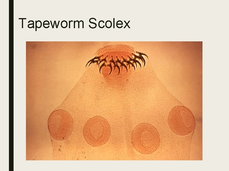Tapeworm Scolex Tapeworm Scolex